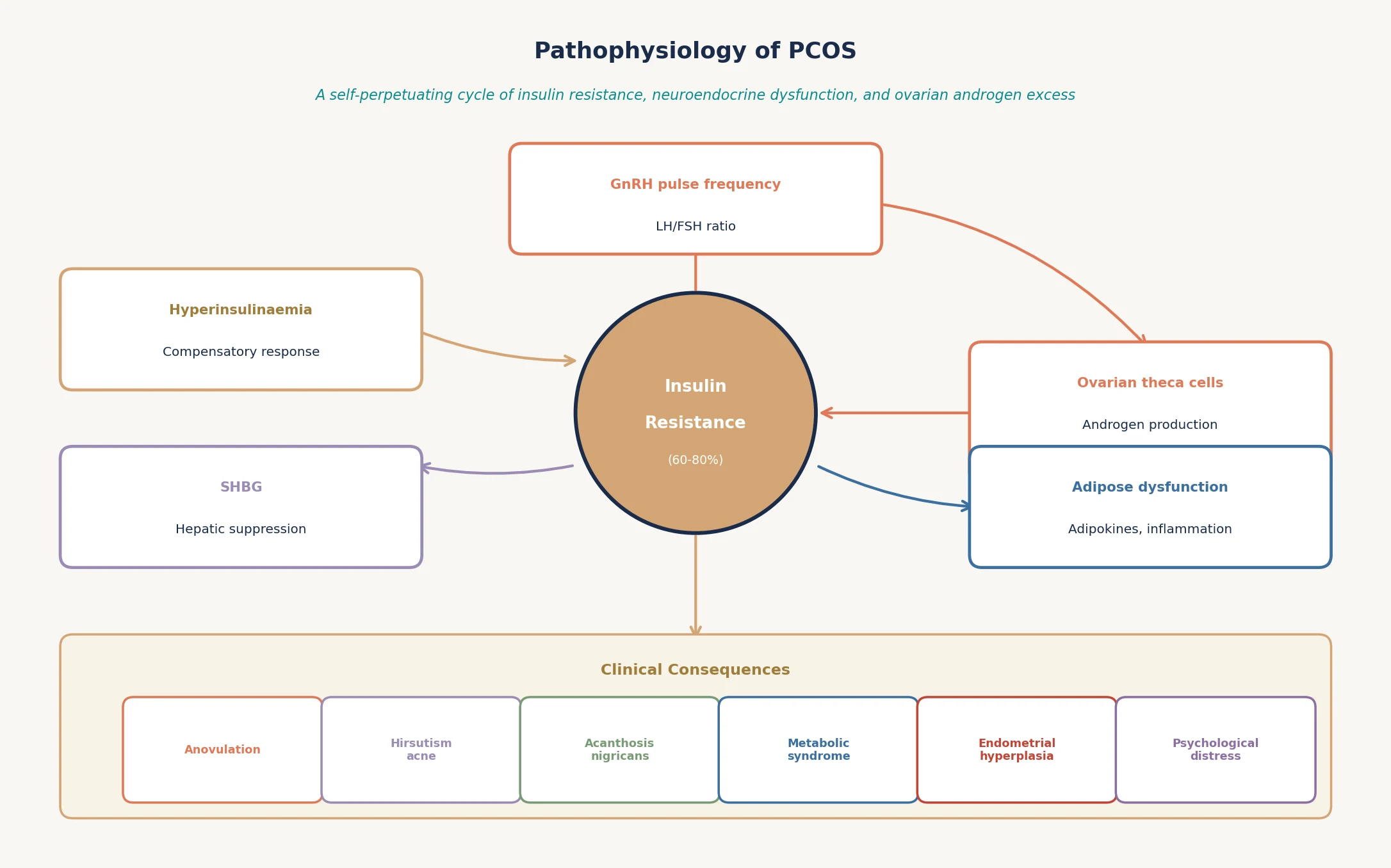 Educational mechanism diagram showing insulin resistance, GnRH pulse changes, ovarian theca cell androgen production, and clinical consequences of PCOS