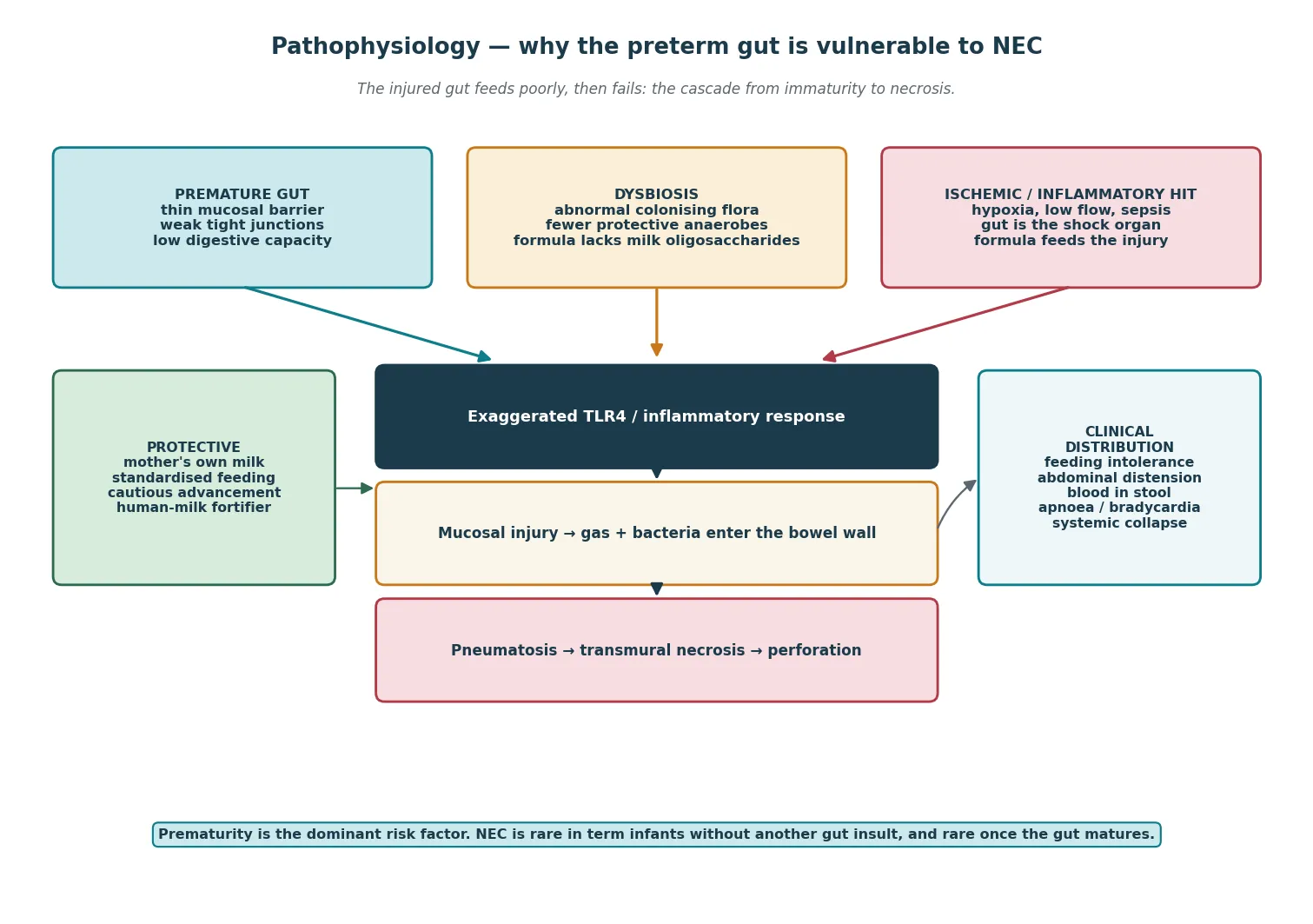 Pathophysiology of necrotising enterocolitis as a three-hit cascade: the premature gut with a thin barrier, dysbiosis from abnormal colonising flora and formula substrate, and an ischaemic or inflammatory insult driving TLR4 inflammation, mucosal injury, pneumatosis intestinalis, transmural necrosis and perforation, beside protective factors and the clinical distribution