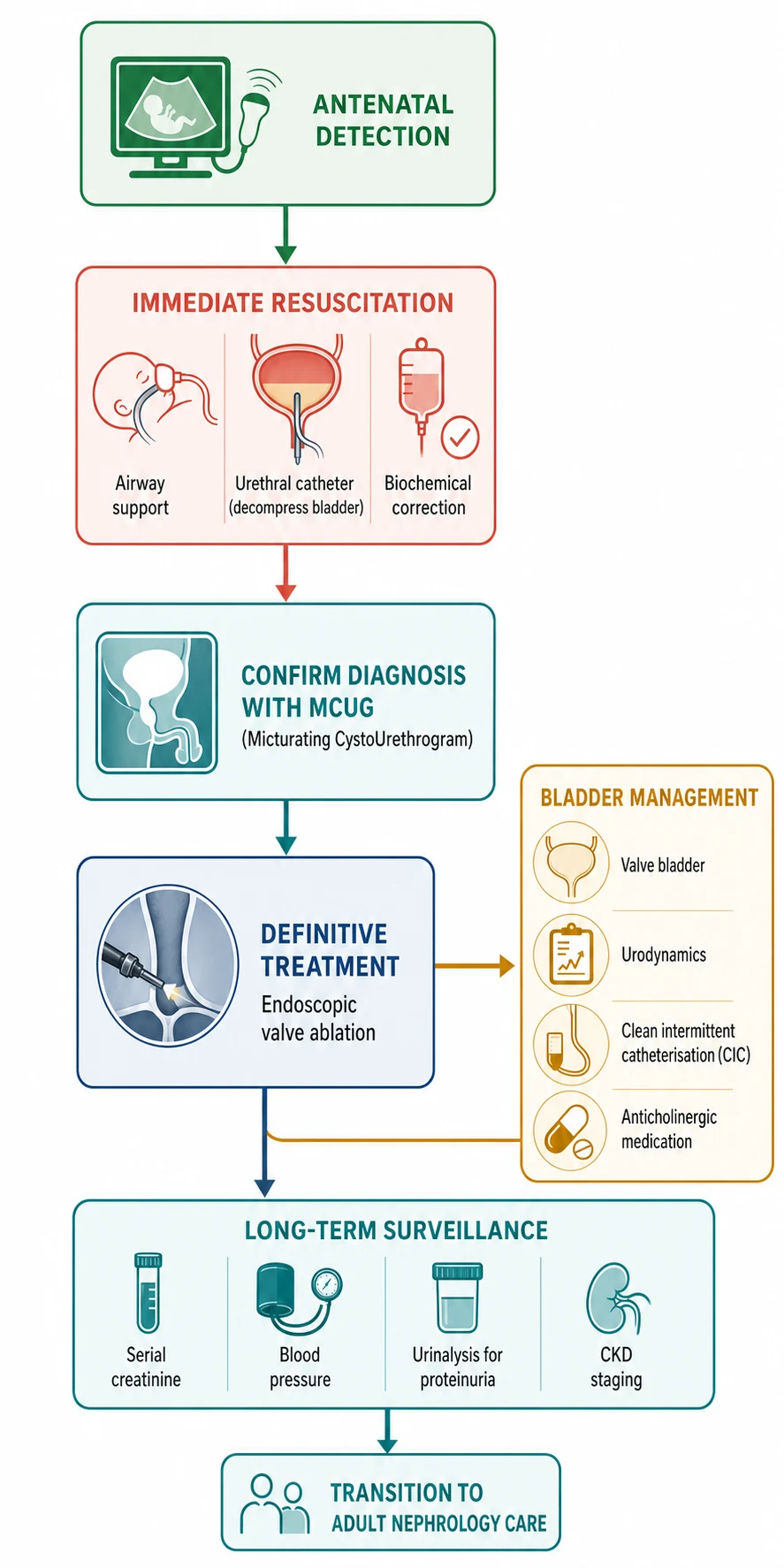 A medical-education management flowchart on a white background showing the stepwise pathway for a male neonate with posterior urethral valves as connected rounded boxes joined by downward arrows: antenatal detection, immediate resuscitation with airway support and a urethral catheter decompressing the bladder, confirm diagnosis with MCUG, definitive treatment with endoscopic valve ablation, bladder management showing the valve bladder with urodynamics, clean intermittent catheterisation and anticholinergic medication, long-term surveillance with serial creatinine, blood pressure, urinalysis for proteinuria and CKD staging, and transition to adult nephrology care.