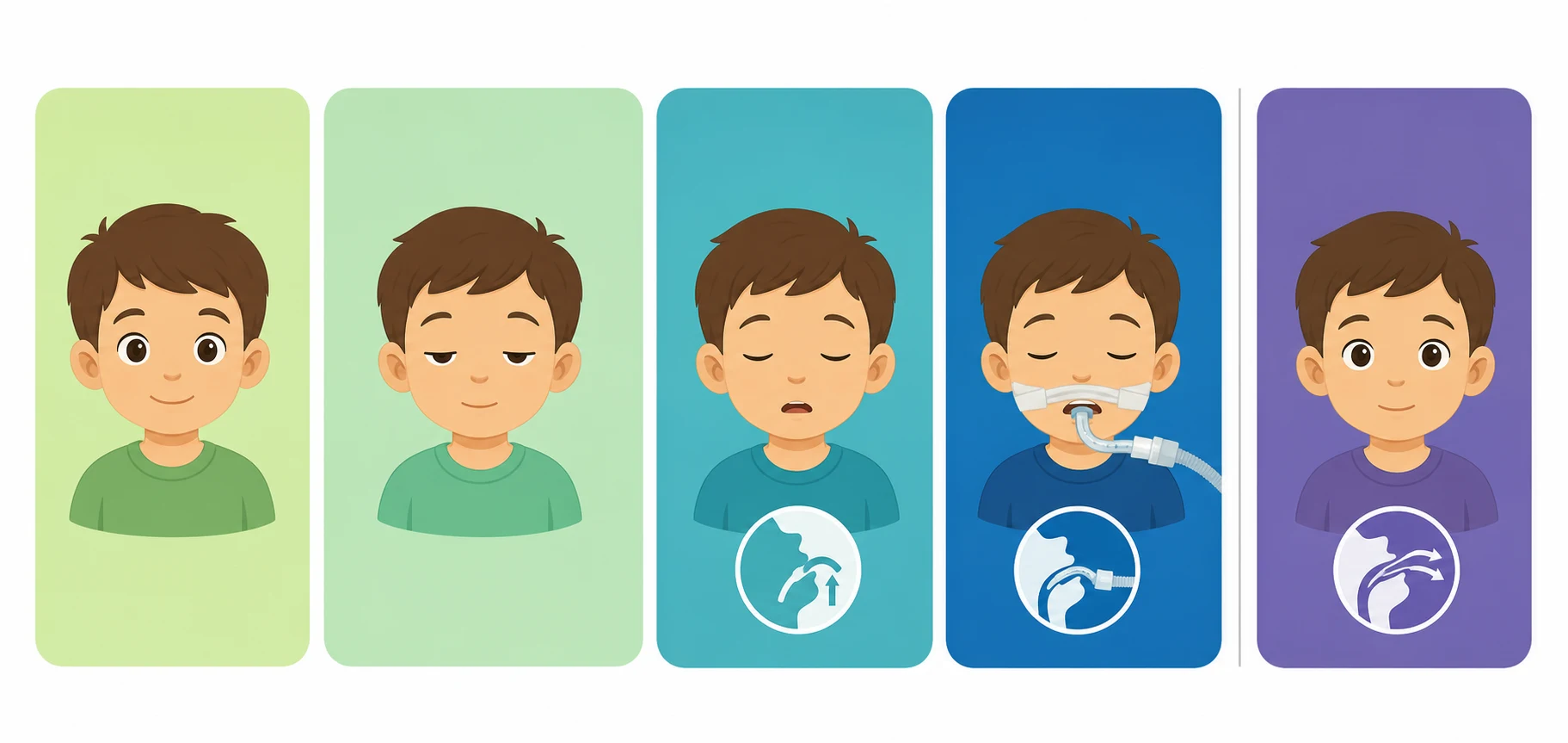 Five horizontal panels showing the sedation continuum from minimal anxiolysis through moderate and deep sedation to general anaesthesia, with a separate ketamine dissociative panel, each naming the typical agents, the airway risk, and the required observer