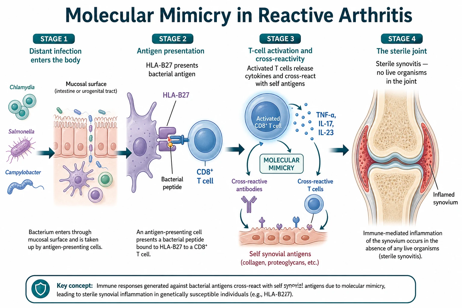 Mechanism diagram showing molecular mimicry in reactive arthritis with HLA-B27 presenting bacterial antigen to CD8-positive T cells, cytokine release of TNF-alpha and interleukin-17, and the resulting sterile synovitis