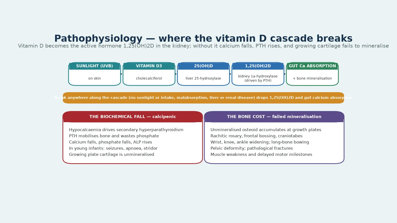 The vitamin D cascade from sunlight through liver and kidney to gut calcium absorption, with the two consequences: a calcipenic biochemical fall with secondary hyperparathyroidism, and the bone cost of failed mineralisation