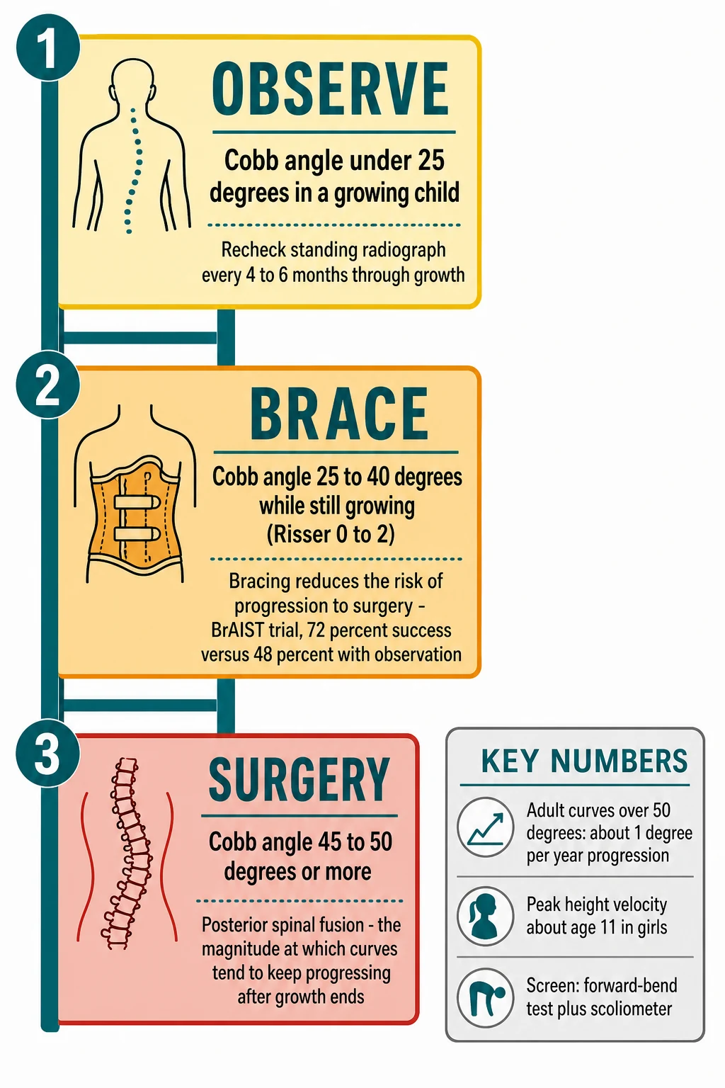Three-step ladder teaching diagram with a side evidence box. Step one in pale yellow titled observe: Cobb angle under 25 degrees in a growing child, recheck standing radiograph every 4 to 6 months through growth. Step two in amber titled brace: Cobb angle 25 to 40 degrees while still growing, Risser 0 to 2, bracing reduces the risk of progression to surgery, BrAIST trial 72 percent success versus 48 percent with observation. Step three in red titled surgery: Cobb angle 45 to 50 degrees or more, posterior spinal fusion, the magnitude at which curves tend to keep progressing after growth ends. Evidence box titled key numbers: adult curves over 50 degrees about 1 degree per year progression, peak height velocity about age 11 in girls, screen with forward-bend test plus scoliometer.