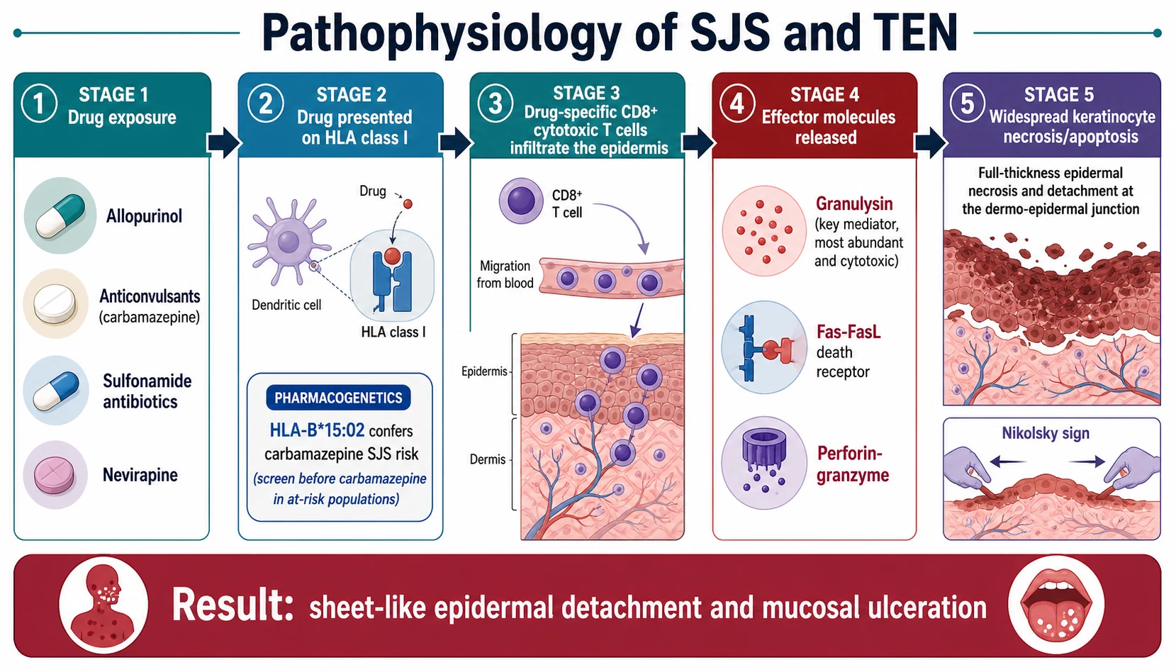 Left-to-right pathophysiology cascade for SJS and TEN: drug exposure to allopurinol, anticonvulsants, sulfonamides or nevirapine, then drug presentation on HLA class I with an HLA-B*15:02 pharmacogenetics callout for carbamazepine, then drug-specific CD8-positive cytotoxic T cells infiltrating the epidermis, then release of the effector molecules granulysin labelled the key and most abundant mediator, Fas-FasL and perforin-granzyme, then widespread full-thickness keratinocyte necrosis and detachment at the dermo-epidermal junction