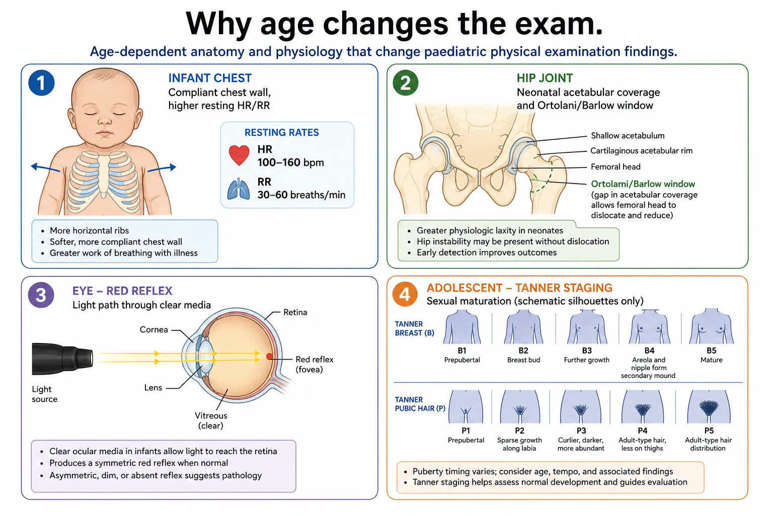 Educational schematic of age-dependent physiology affecting heart rate, breathing, hip stability, red reflex and adolescent development during examination