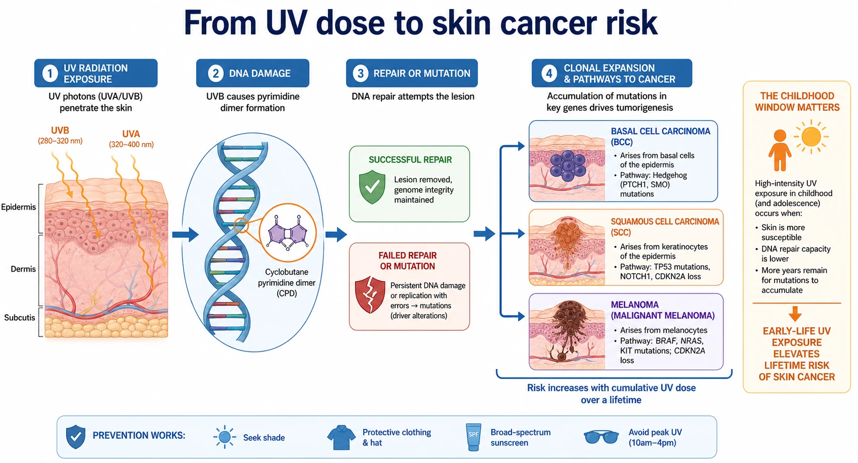 Educational flow diagram from UV photons to DNA lesions and mutation risk with branches toward basal cell carcinoma, squamous cell carcinoma and melanoma, highlighting childhood exposure