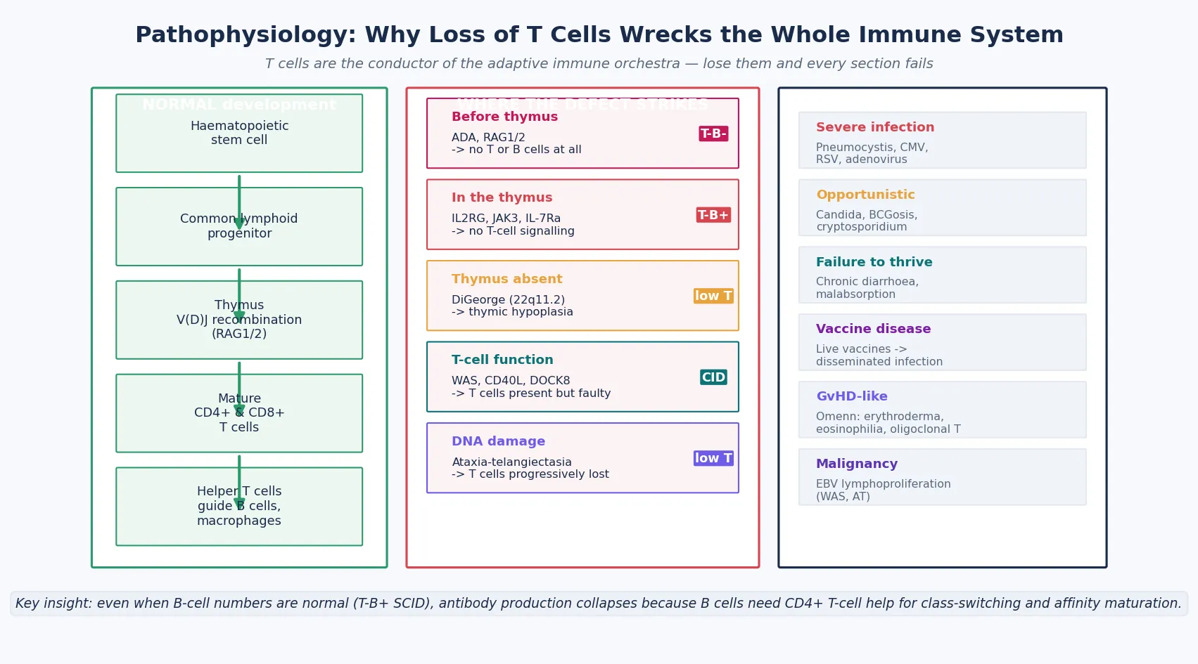 Three-column pathophysiology cascade: the left column shows normal T-cell development from haematopoietic stem cell through common lymphoid progenitor and thymic V(D)J recombination to mature CD4+ and CD8+ T cells and helper function; the middle column shows where each defect strikes — before the thymus (ADA, RAG1/2 producing T-B-NK- and T-B-NK+), in the thymus (IL2RG, JAK3, IL-7 receptor alpha producing T-B+NK- and T-B+NK+), absent thymus (DiGeorge/22q11.2), T-cell function (WAS, CD40L, DOCK8), and DNA damage (ataxia-telangiectasia); the right column lists the consequences (severe infection, opportunistic infection, failure to thrive, vaccine-derived disease, graft-versus-host-like Omenn, malignancy)