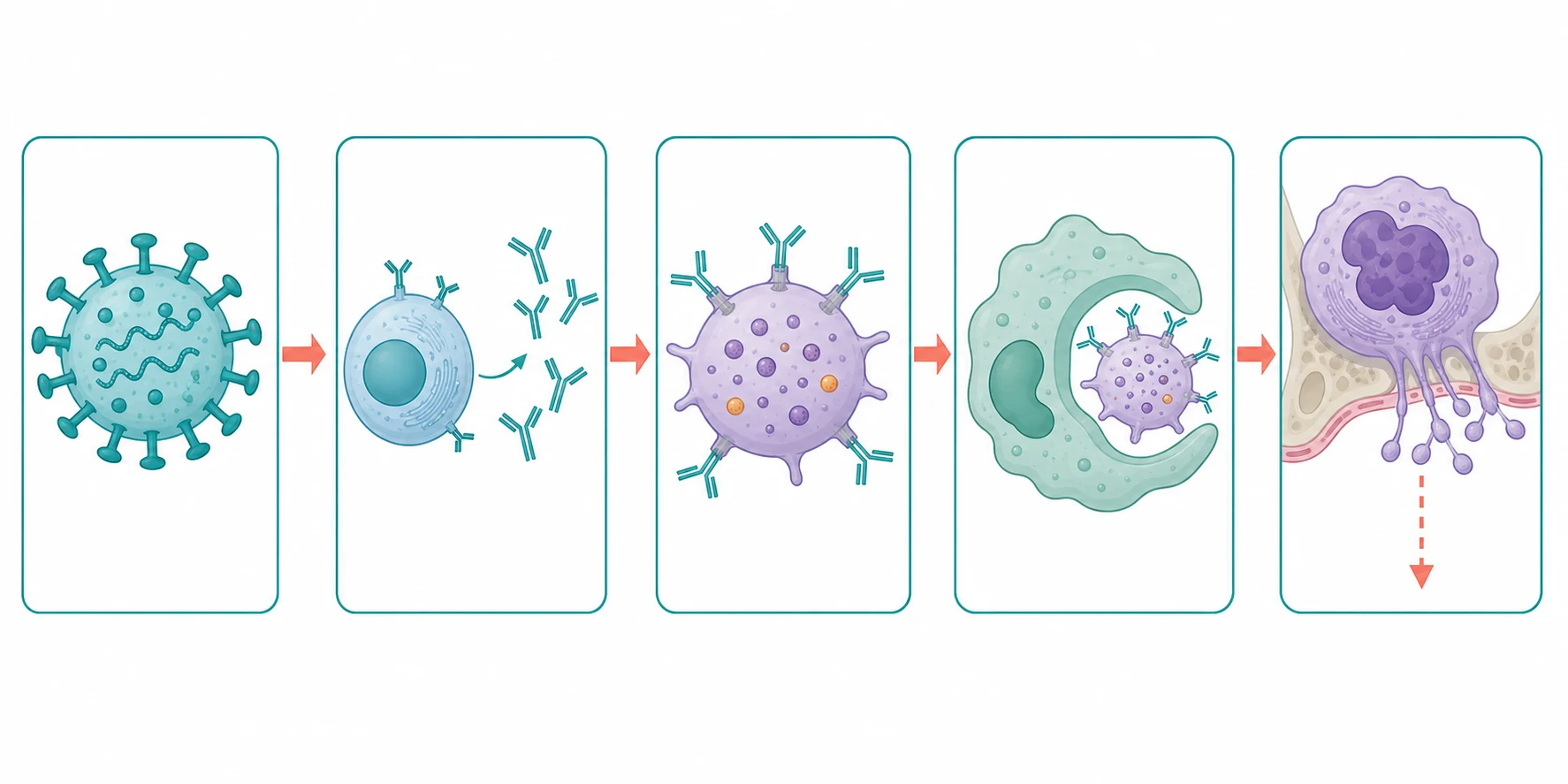 A clean scientific causal schematic on a white background. Five connected boxes flowing left to right, joined by coral arrows. Box one shows a virus particle representing the viral trigger one to four weeks earlier. Box two shows a B-lymphocyte producing Y-shaped antibody molecules. Box three shows the Y-shaped antibodies coating the surface of a large platelet decorated with glycoprotein receptors. Box four shows a splenic macrophage engulfing the antibody-coated platelet, labelled accelerated destruction. Box five shows a megakaryocyte in the bone marrow with a downward dashed arrow labelled impaired platelet production.
