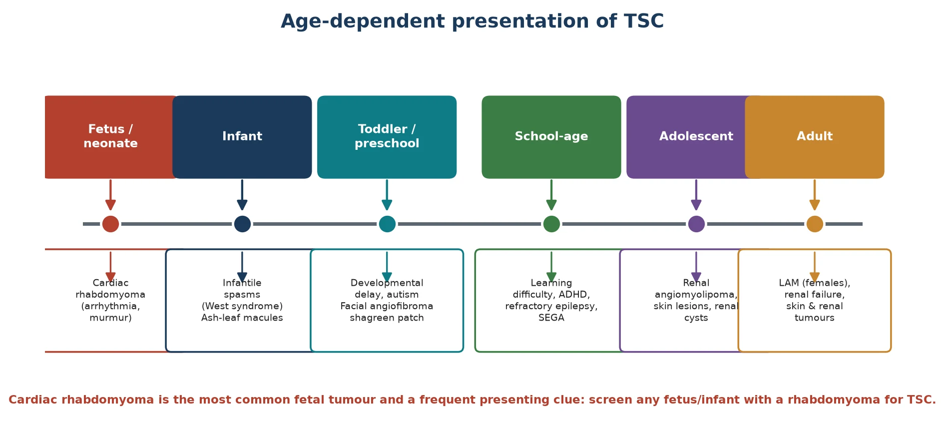 Age-dependent presentation timeline of tuberous sclerosis complex running left to right across six life stages: fetus or neonate with cardiac rhabdomyoma and arrhythmia, infant with infantile spasms and ash-leaf macules, toddler or preschool with developmental delay autism facial angiofibroma and shagreen patch, school-age with learning difficulty ADHD refractory epilepsy and SEGA, adolescent with renal angiomyolipoma skin lesions and renal cysts, and adult female with lymphangioleiomyomatosis renal failure and skin and renal tumours
