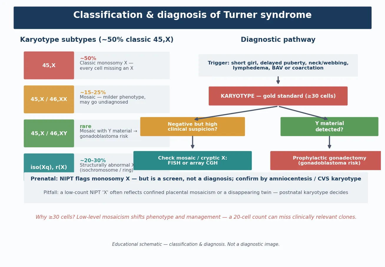 Five Turner syndrome karyotype classes shown as columns — classic 45,X monosomy, 45,X/46,XX mosaicism, 45,X/46,XY mosaicism (flagged for gonadoblastoma), isochromosome Xq (i(Xq)), and ring X or partial deletion — each with karyotype shorthand, approximate frequency, phenotype severity, and clinical action such as gonadectomy for Y-bearing lines, with a footer naming peripheral blood karyotype as the first-tier test and FISH or array for confirmation