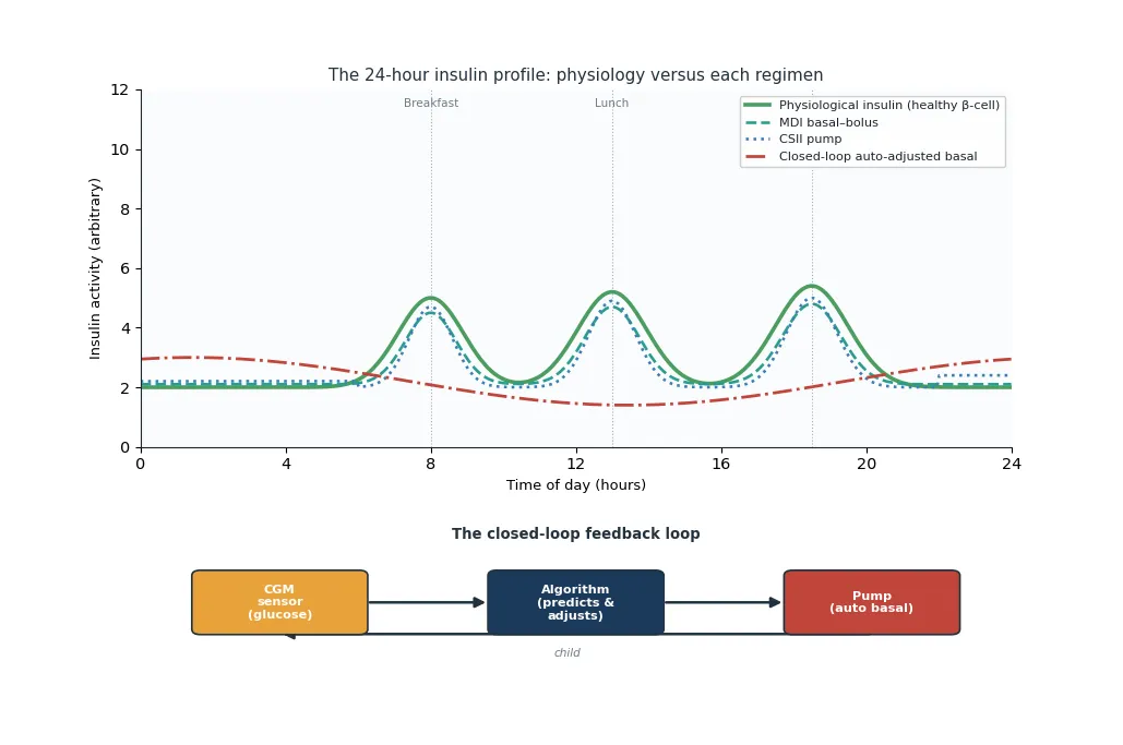 Twenty-four-hour insulin activity profiles comparing physiological pancreatic secretion, a multiple-daily-injection basal-bolus regimen, a continuous subcutaneous insulin infusion pump, and a closed-loop auto-adjusted basal, with the sensor-algorithm-pump feedback loop shown beneath.