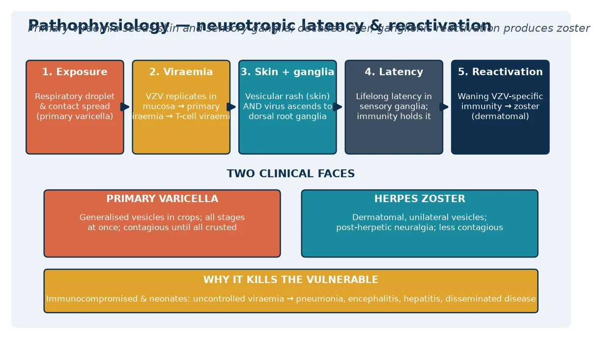 Left-to-right pathophysiology cascade: exposure to varicella-zoster virus by droplet and contact, primary and T-cell viraemia seeding skin and sensory ganglia, ganglionic latency held by cell-mediated immunity, and reactivation producing dermatomal herpes zoster; with a two-clinical-faces ribbon and an infant-vulnerability footer