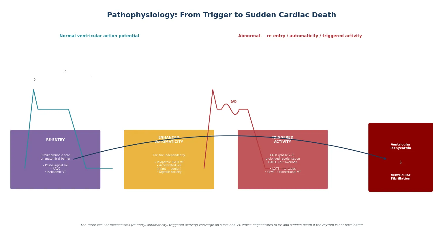 Educational mechanism diagram showing the normal versus abnormal ventricular action potential with early afterdepolarisations, the three cellular mechanisms (re-entry around scar, enhanced automaticity from an outflow-tract focus, and triggered activity from EADs in LQTS and DADs in CPVT), and the convergence of all three on sustained ventricular tachycardia and ventricular fibrillation
