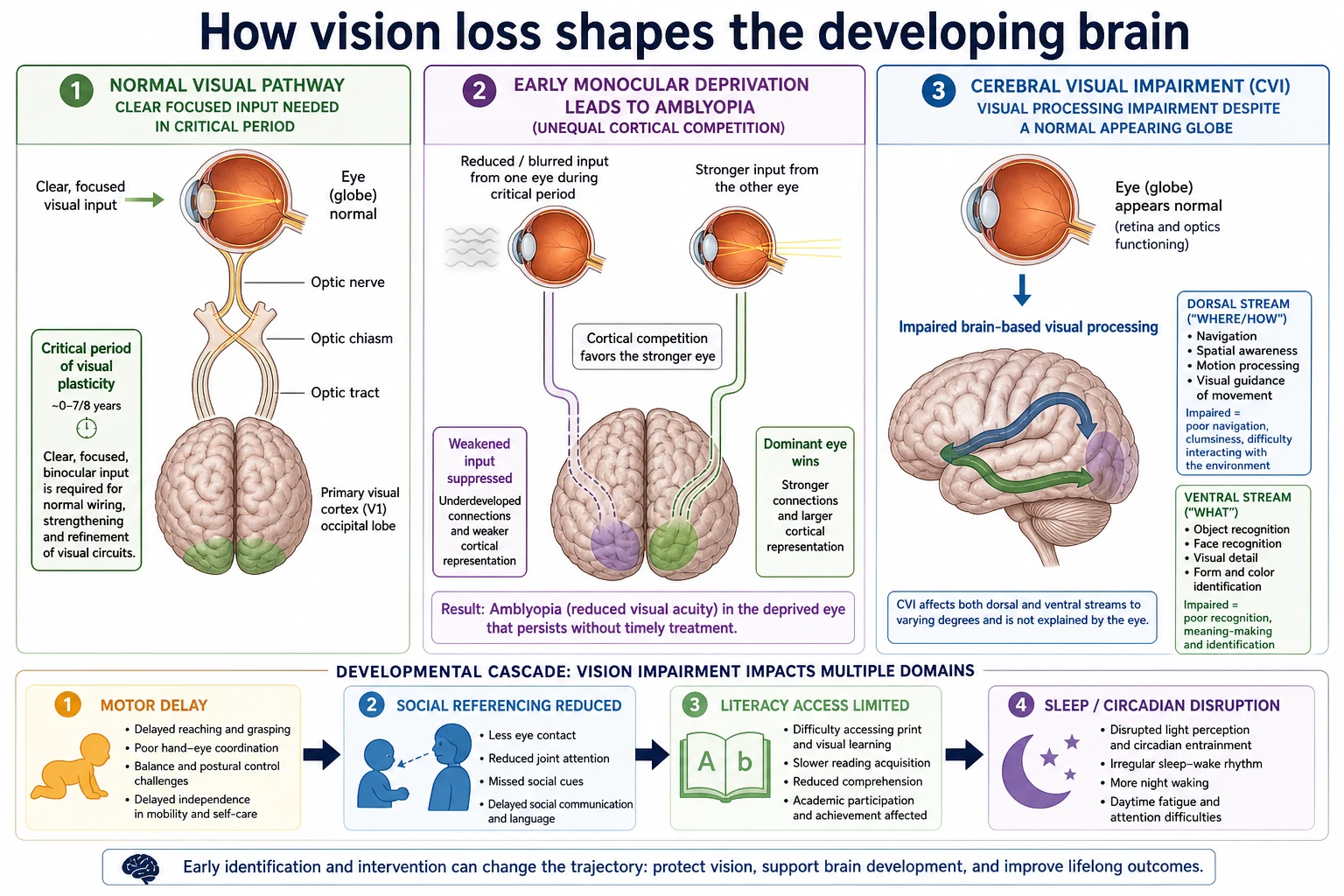 Mechanism diagram showing critical-period amblyopia from early monocular deprivation and cerebral visual impairment with dorsal and ventral stream dysfunction
