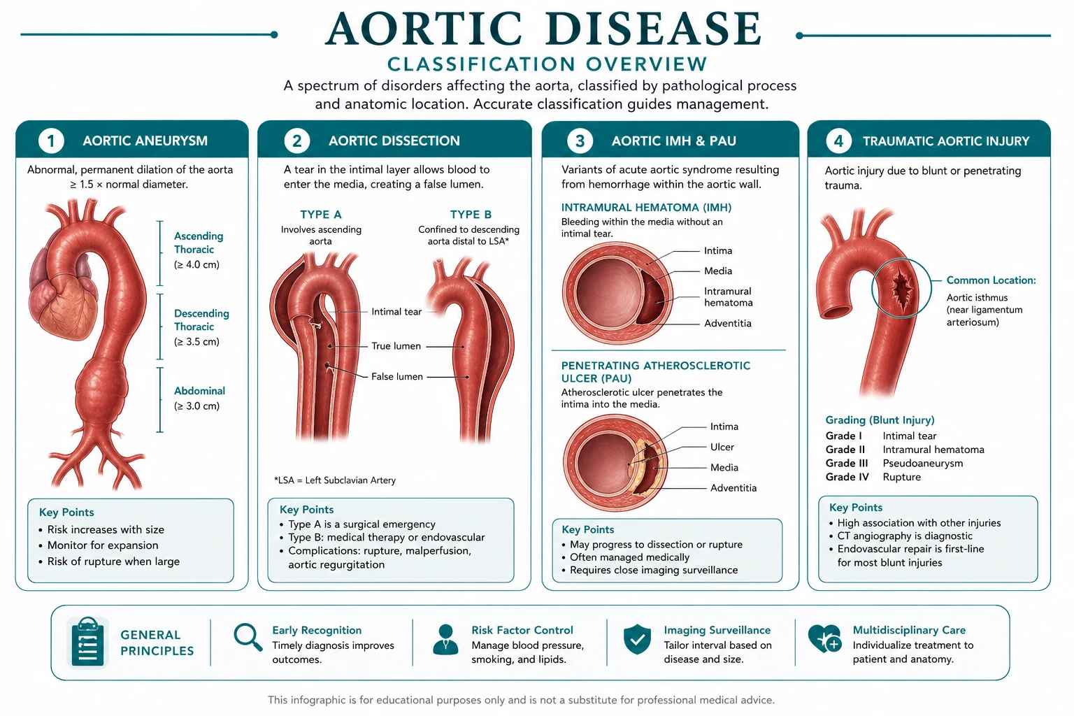 Classification diagram for Aortic Disease.