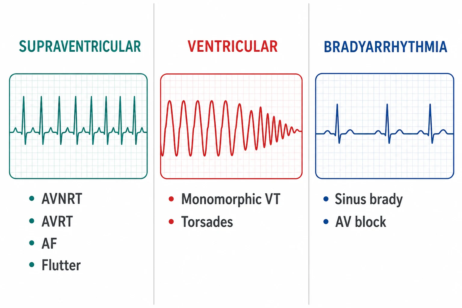 Classification of arrhythmias into supraventricular, ventricular and bradyarrhythmia families