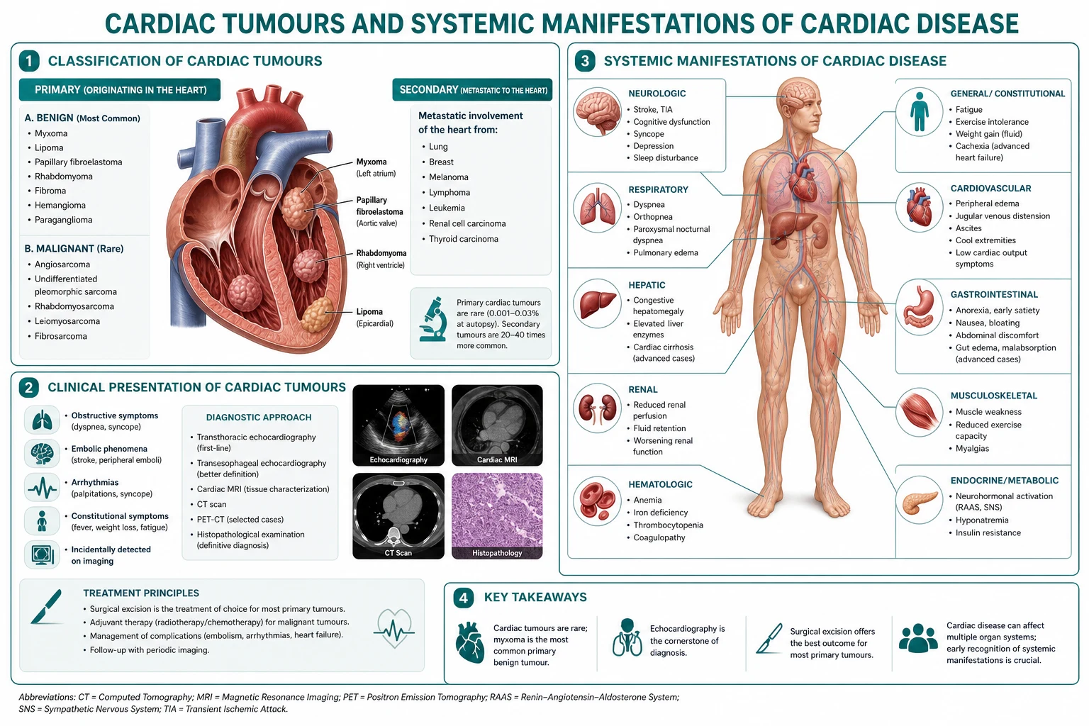 Classification of cardiac tumours — benign vs malignant, primary vs metastatic.