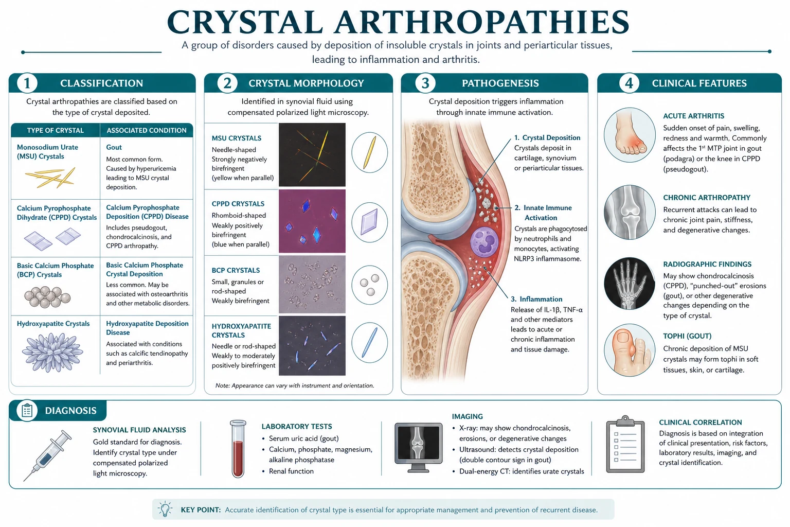 Classification diagram for Crystal Arthropathies.