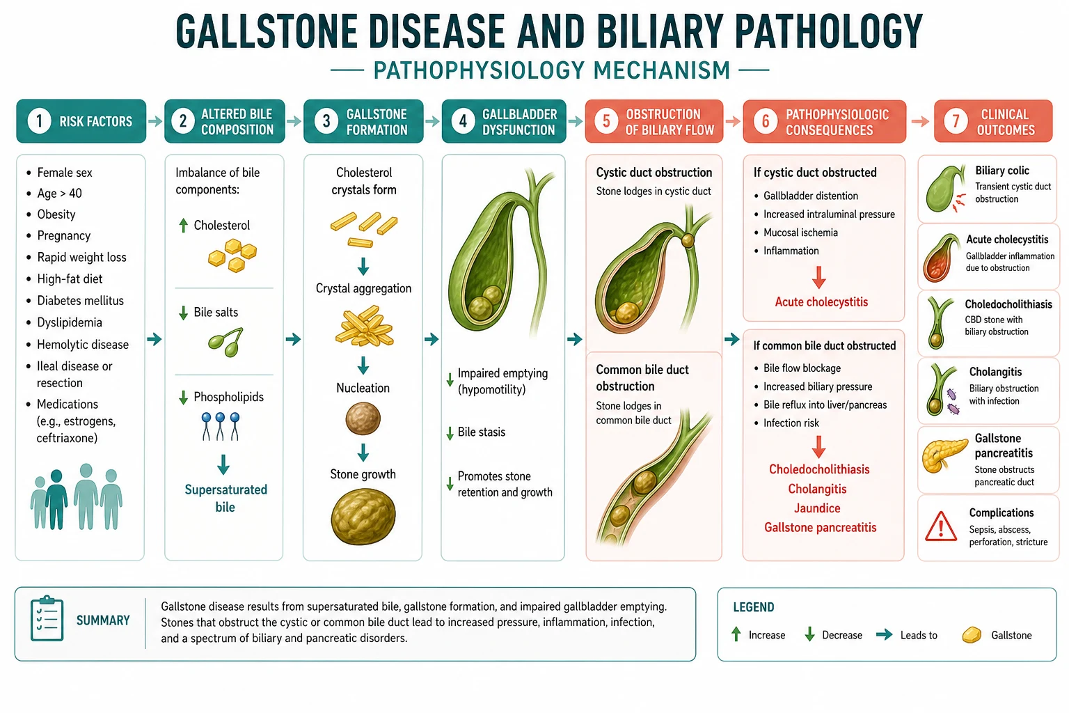 Pathophysiology mechanism diagram for Gallstone Disease AND Biliary Pathology.
