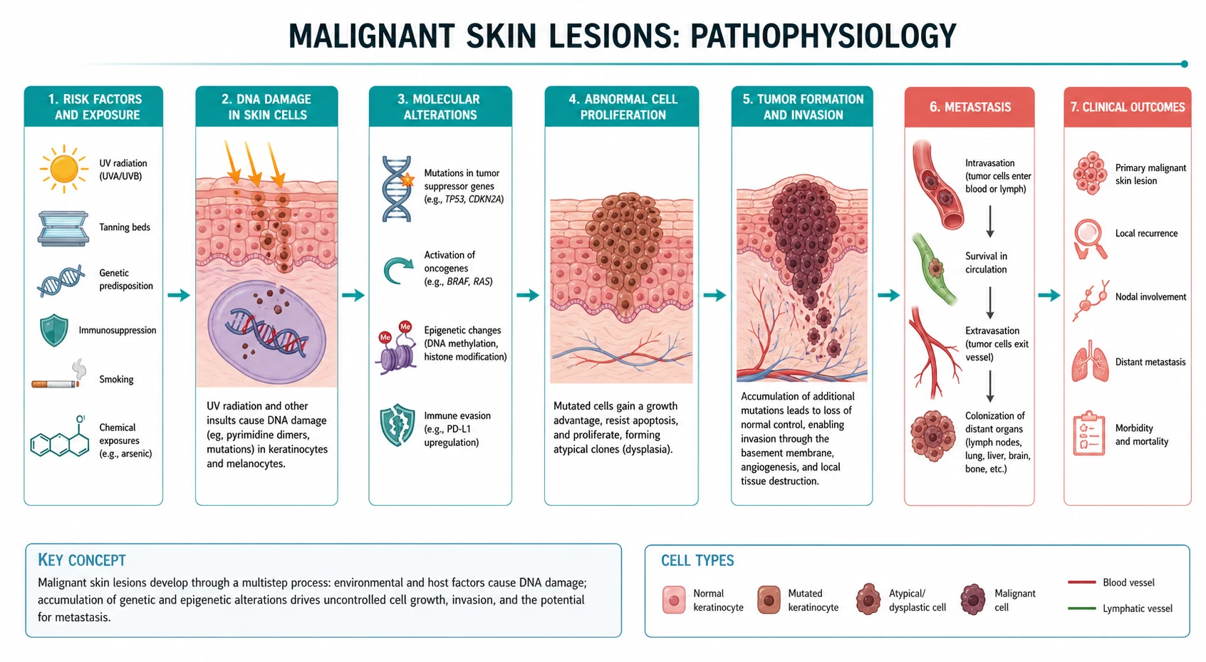 Pathophysiology mechanism diagram for Malignant Skin Lesions.