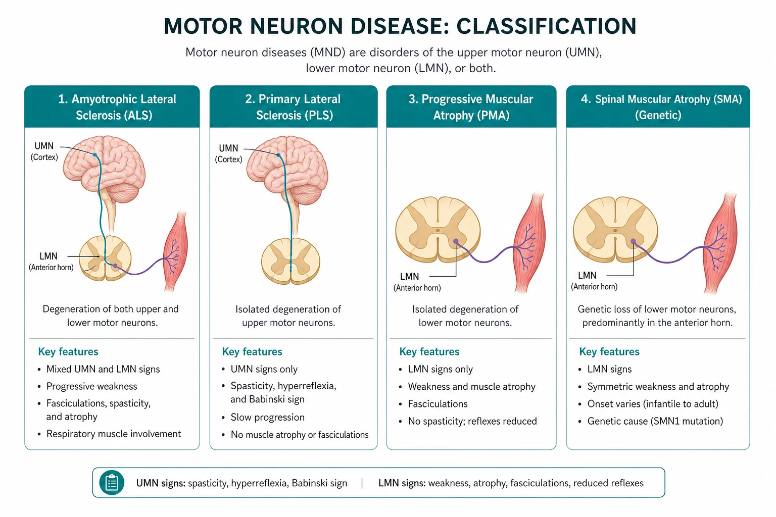 Classification for motor neuron disease