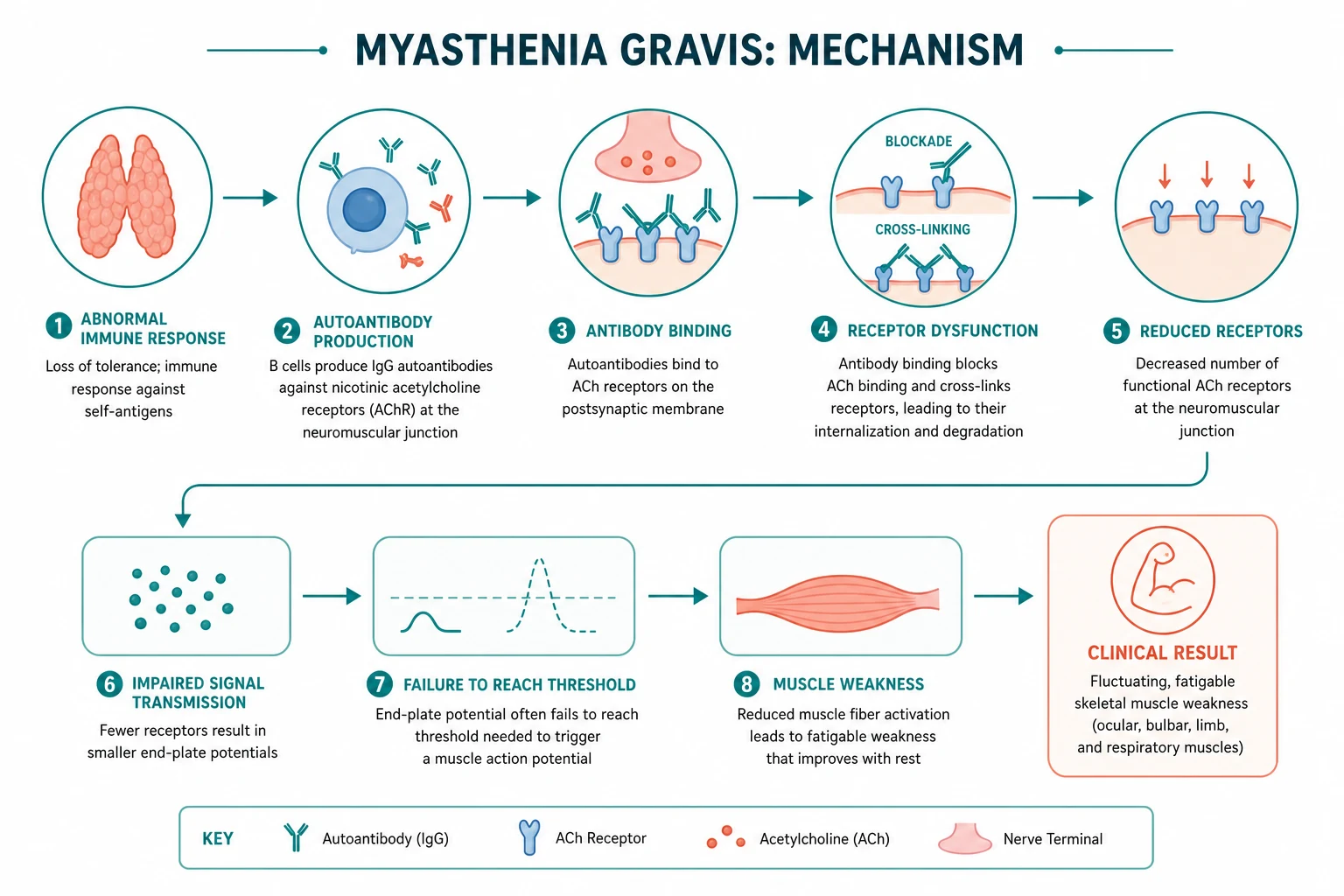 Pathophysiology for myasthenia gravis