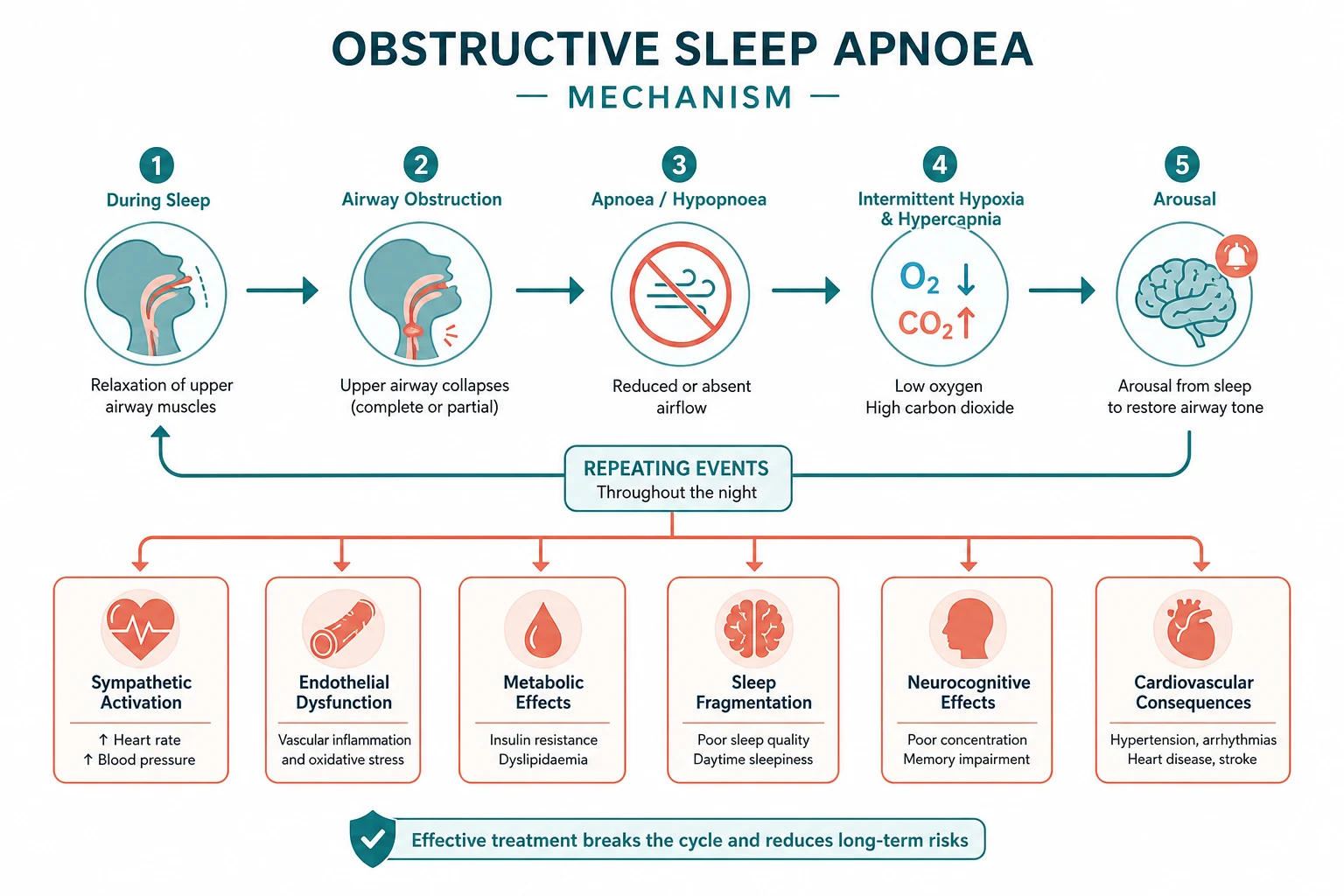 OSA pathophysiology — narrow collapsible pharyngeal airway, loss of genioglossus tone in REM, cyclical obstruction and arousal