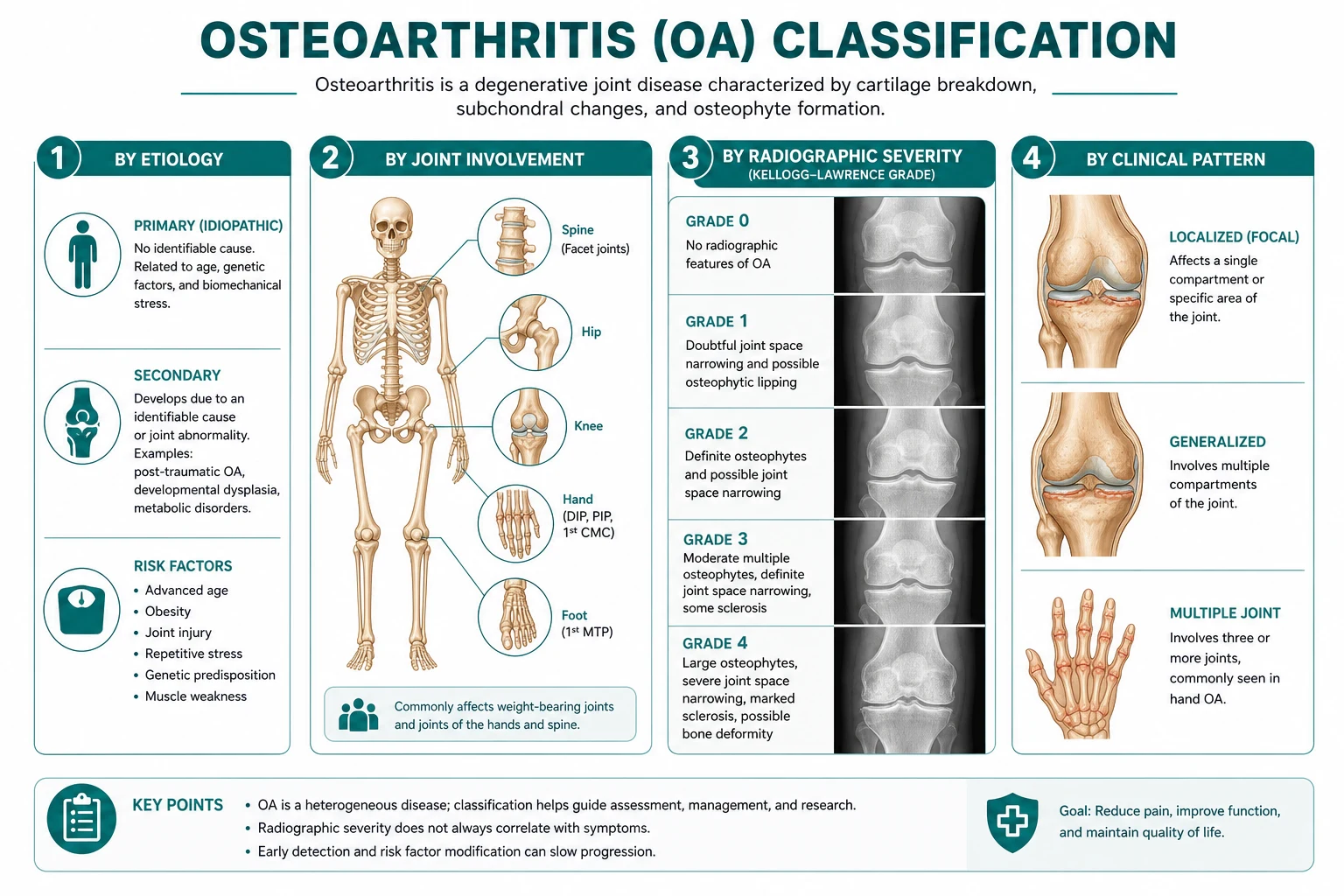 Classification diagram for Osteoarthritis.