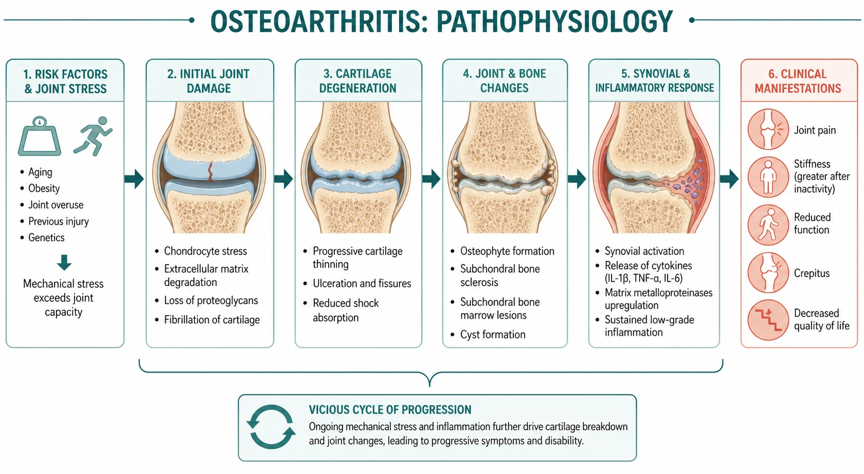 Pathophysiology mechanism diagram for Osteoarthritis.