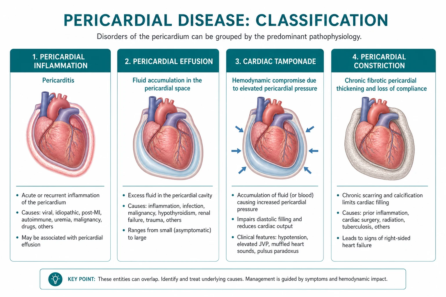 Classification for pericardial disease