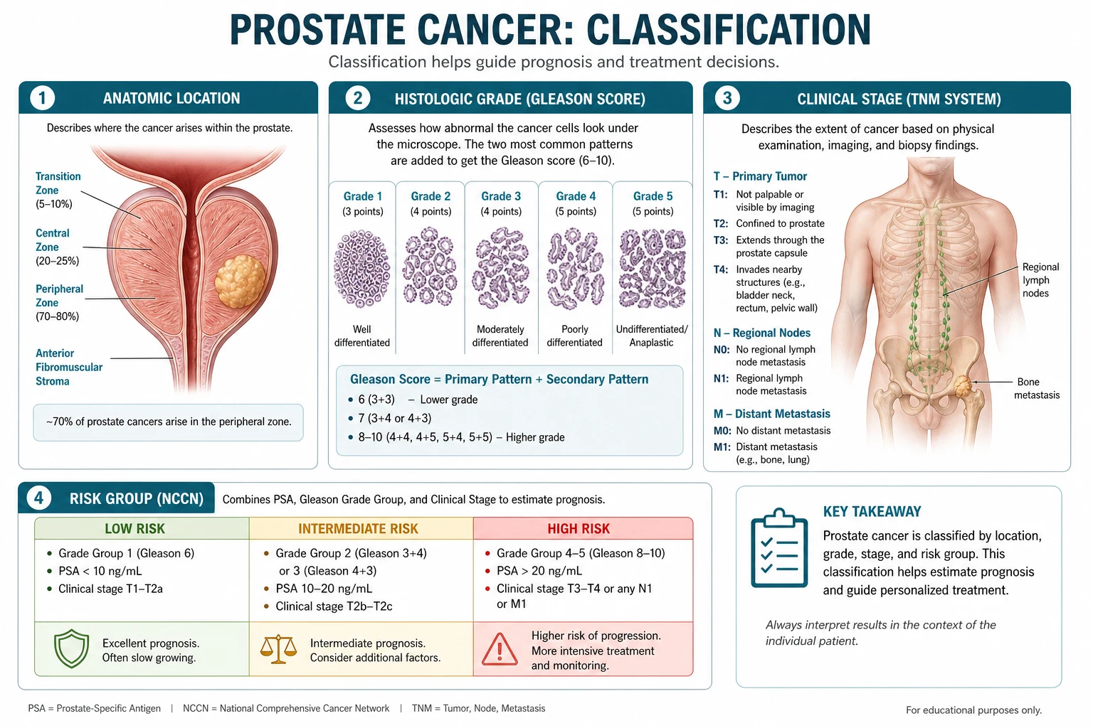 Classification diagram for Prostate Cancer.