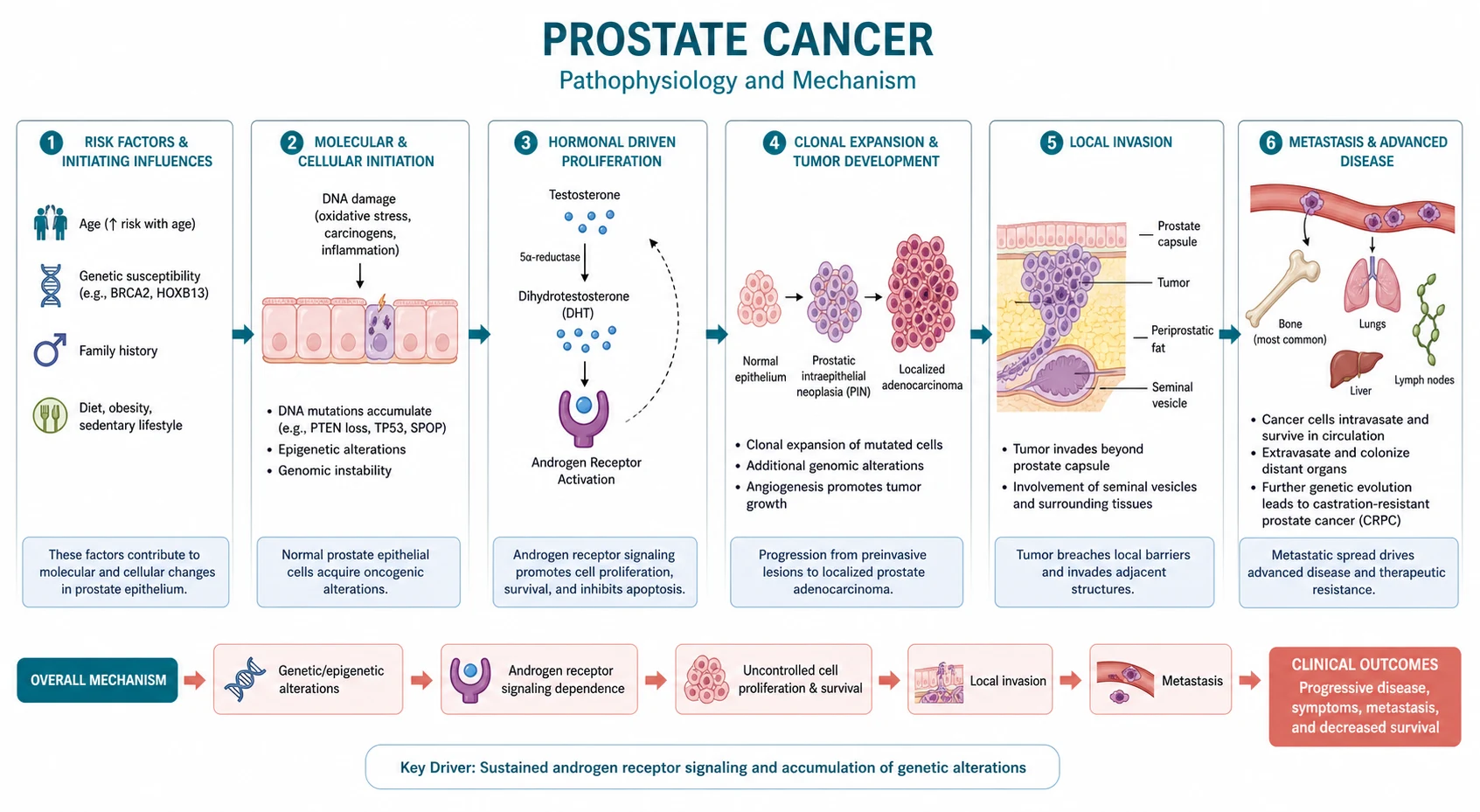 Pathophysiology mechanism diagram for Prostate Cancer.
