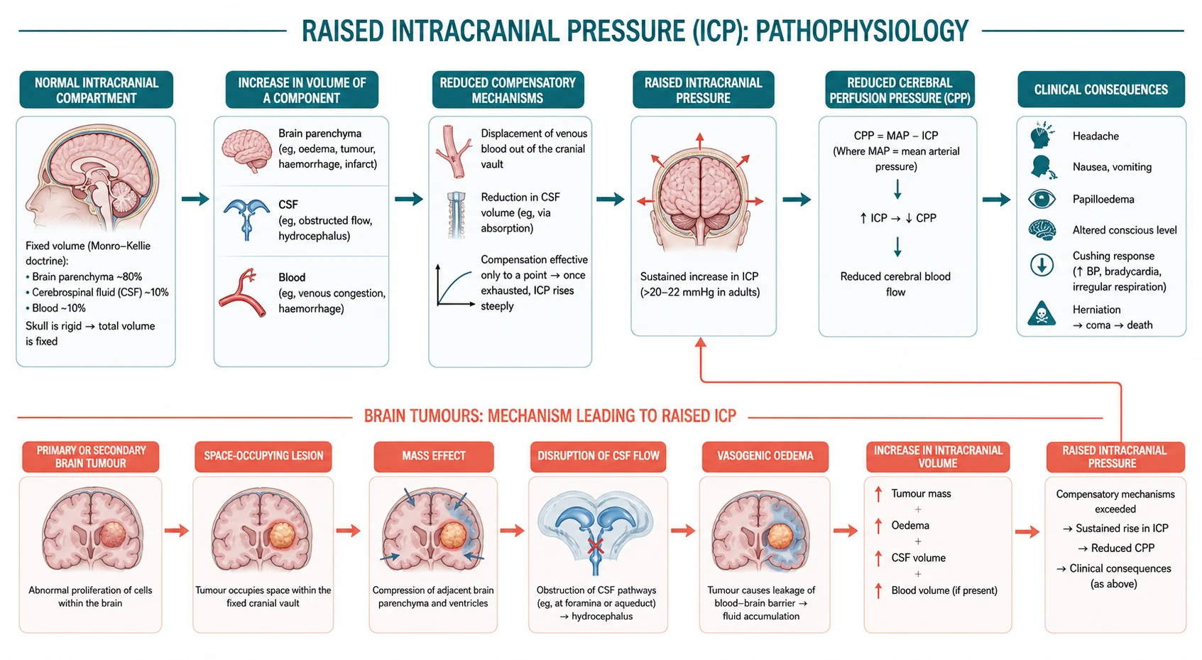 Pathophysiology mechanism diagram for Raised Intracranial Pressure AND Brain Tumours.