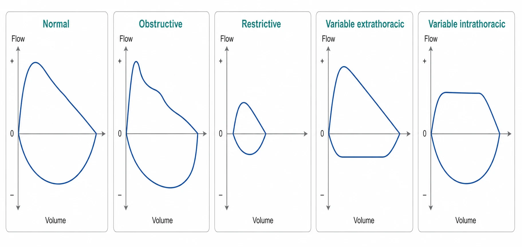 Flow-volume loop patterns: normal, obstructive, restrictive, variable extrathoracic and variable intrathoracic upper airway obstruction