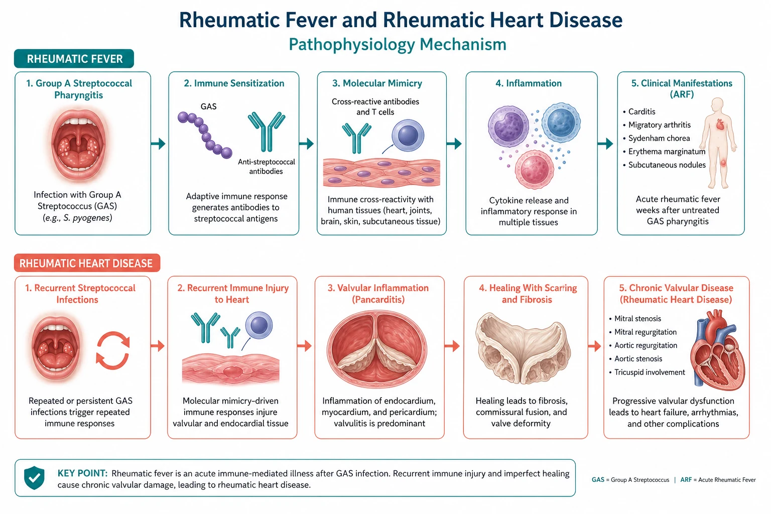 Pathophysiology mechanism diagram for Rheumatic Fever AND Rheumatic Heart Disease.