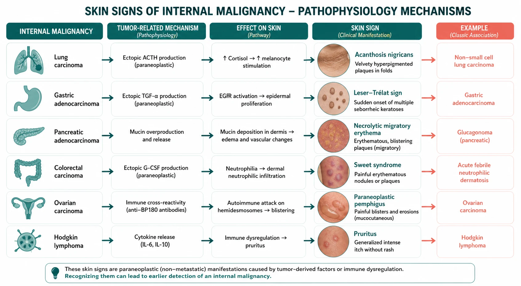 Pathophysiology mechanism diagram for Skin Signs OF Internal Malignancy.