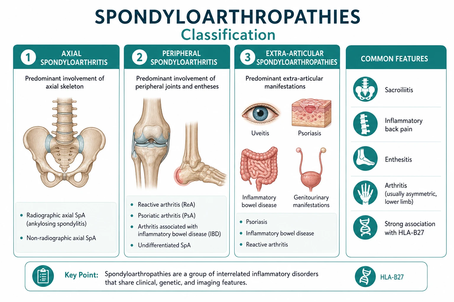 Classification of spondyloarthropathies