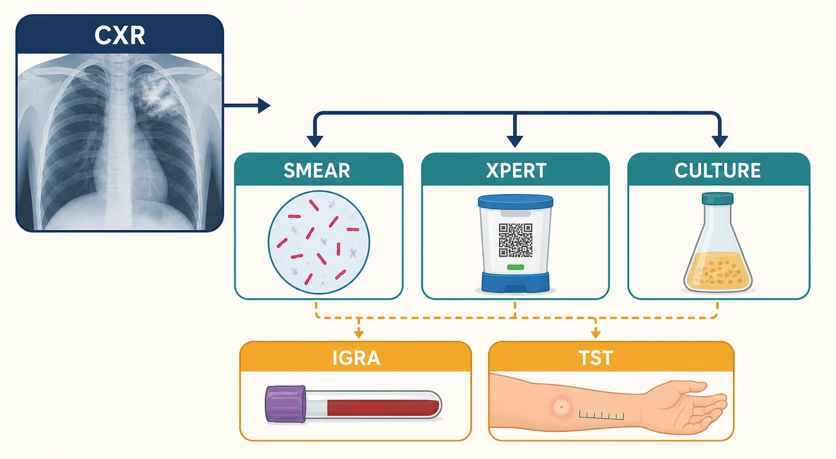 Flowchart infographic of tuberculosis diagnosis — chest X-ray, sputum smear, Xpert NAAT and culture, with IGRA and TST reserved for latent infection