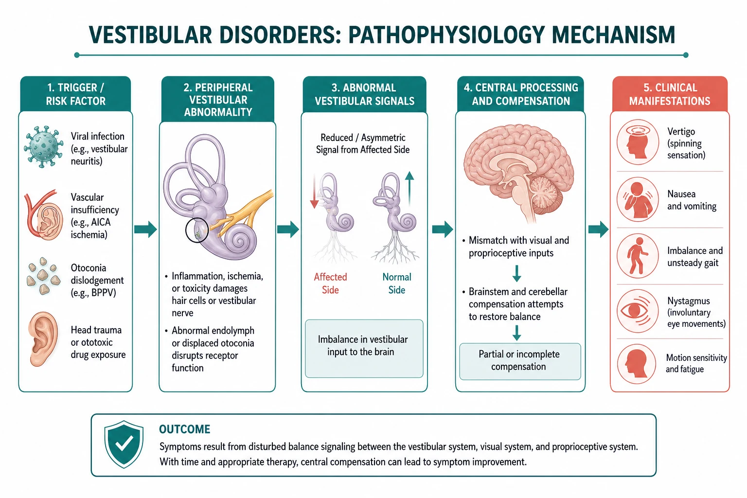 Pathophysiology mechanism diagram for Vestibular Disorders.