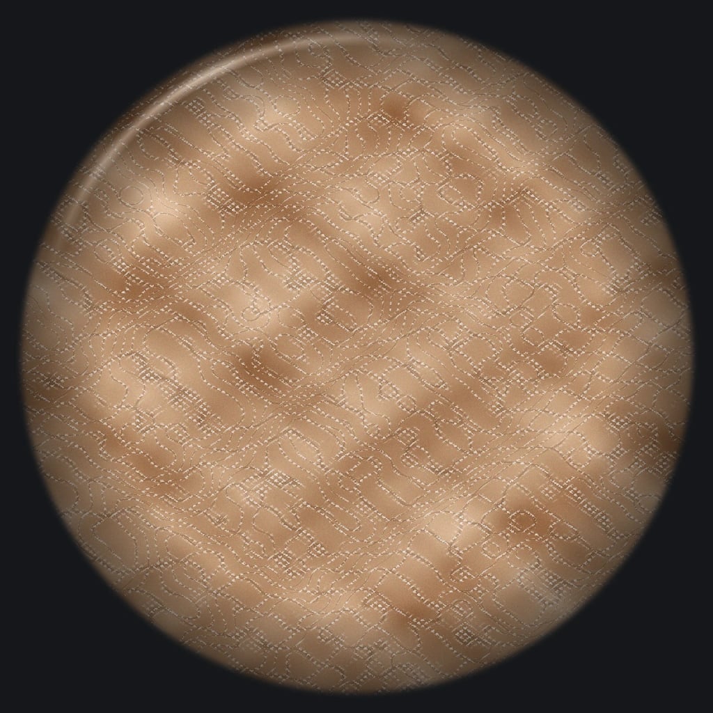 Dermoscopy of pityriasis versicolor showing fine white scale along skin furrows forming a wire-fence pattern on a background of altered pigmentation