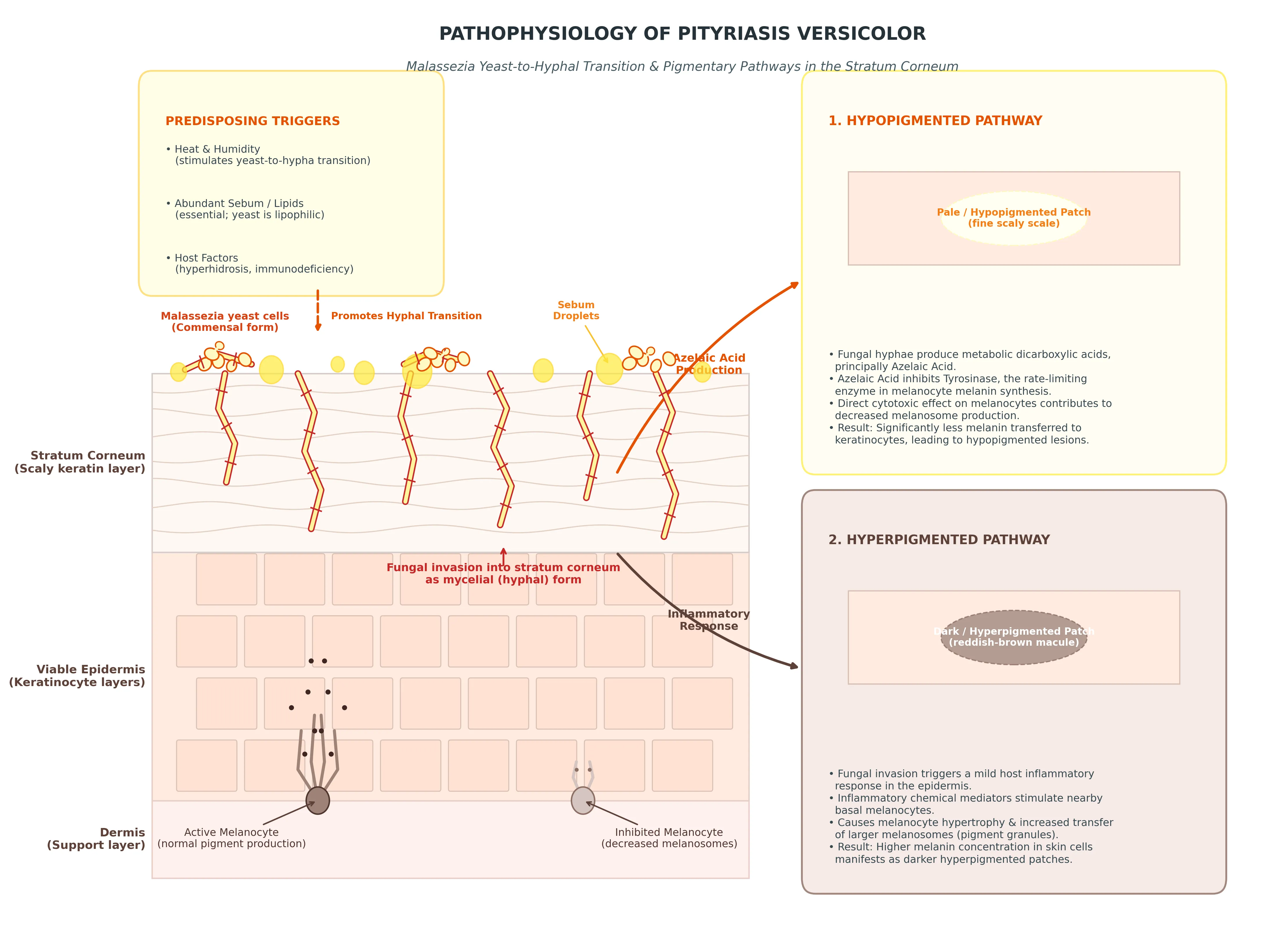 Diagram showing Malassezia yeast transitioning to mycelial form within stratum corneum, with lipid dependence and pigmentary effects