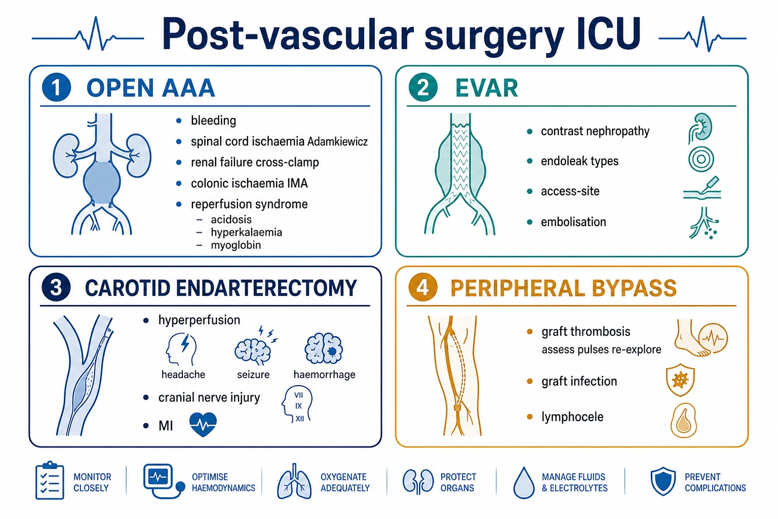 Four-section infographic on a white clinical-blue background: OPEN AAA (bleeding; spinal cord ischaemia — Adamkiewicz; renal failure; colonic ischaemia; reperfusion); EVAR (contrast nephropathy; endoleak types I to V; access-site; embolisation); CAROTID ENDARTERECTOMY (hyperperfusion syndrome; cranial nerve injury; MI); PERIPHERAL BYPASS (graft thrombosis — assess pulses, re-explore; graft infection; lymphocele). Flat vector illustration, crisp typography.